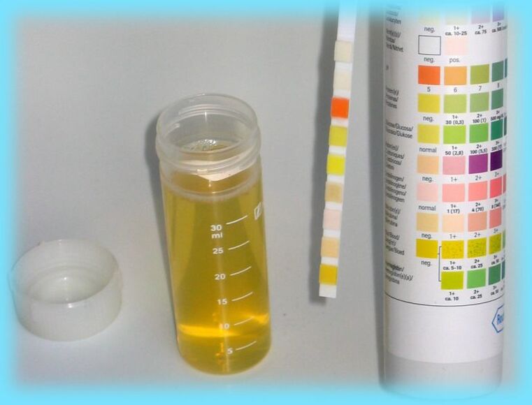 Analyse d'urine