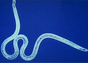 Parasite